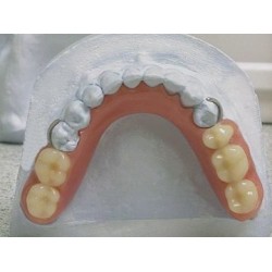 Partially removable denture