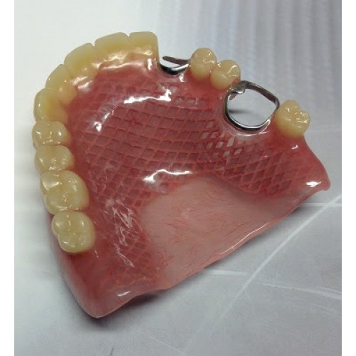 Reinforced partial denture