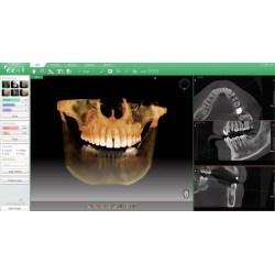 PaX-i3D 10 х 8,5 (12 х 9)| VATECH South Korea
