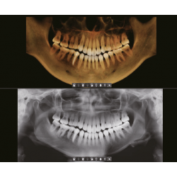 PaX-i3D 10 х 8,5 (12 х 9)| VATECH South Korea